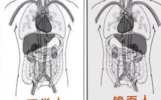 女子就医发现五脏六腑全长反 医生科普：镜面人 医学上无科学定论！