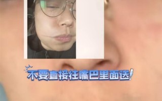 男子吃烧烤被烫出微笑唇：忽略了烤肉的铁签子温度高！